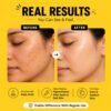 Tan Removal Soap Men and Women Pigmentation & Dark Spot Removal Bar with Vitamin E, Coconut Oil, Shea Butter & Olive Oil | Handmade Soap | Skin Whitening