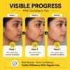 Tan Removal Soap Men and Women Kojic Acid Face Soap For Skin Brightening